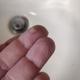 Another view of the offending infection.